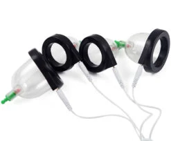 Electro Cupping Set Van FM Electrosex